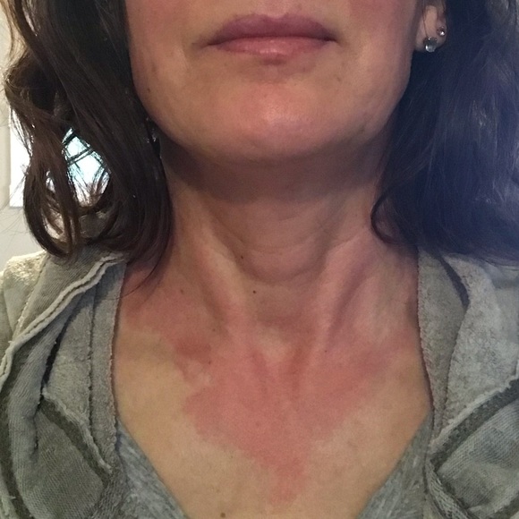 Venex® 1 Bee venom ointment w/honeybee venom
Natural Botox & great pain therapy - Picture 4 of 6